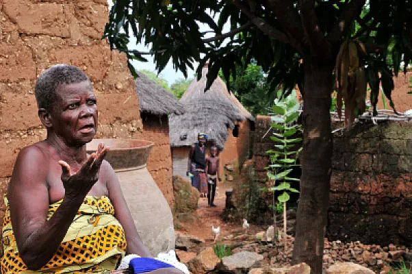Public and Private Universities in Togo: How to Choose